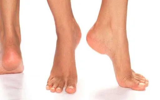 Здоровые ножки