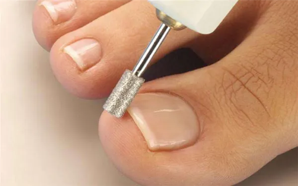Аппаратный педикюр: формирование свободного края ногтей